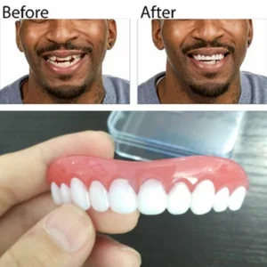 Sourire instantané parfait