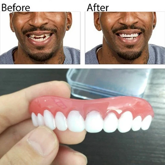 Sourire instantané parfait